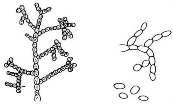 链孢霉的形态特征