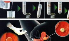 鸡人工授精的准备和采精、输精方法